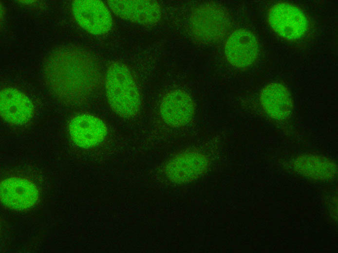 Antikörper gegen ein unbekanntes Zellzyklus-abhängiges Antigen auf HEp-2 Zellen