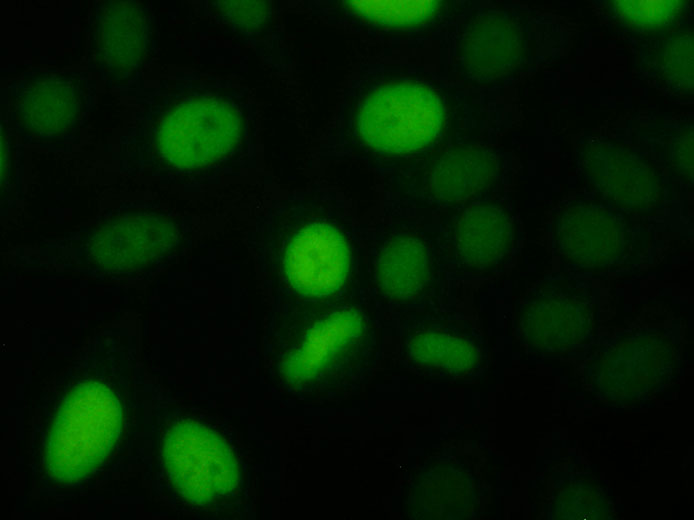Antikörper gegen ein unbekanntes Zellzyklus-abhängiges Antigen auf HEp-2 Zellen