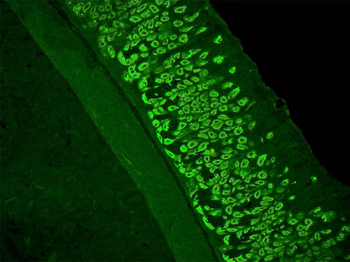Antikörper gegen Belegzellen auf Maus Magen