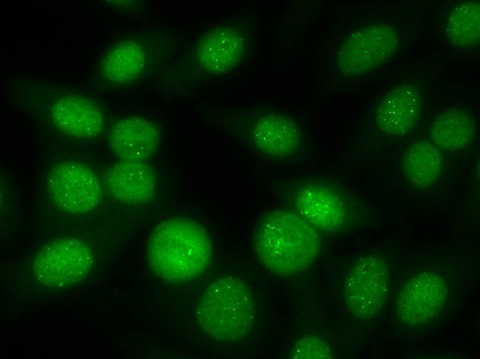 Anti-RNA Polymerase III