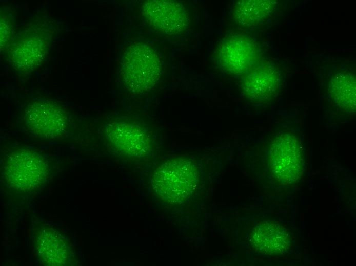 Anti-RNA Polymerase III